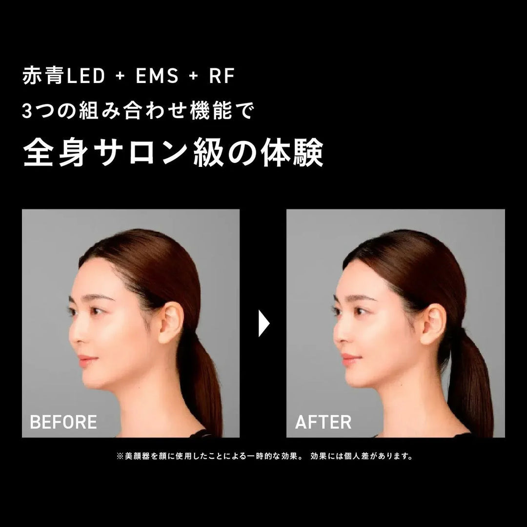 ブライト エレキブラシ＋ ブラシ型美顔器｜Brighte