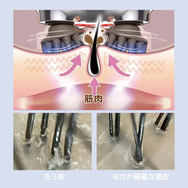 ゾーガンキン スカルプ｜ZOGANKIN